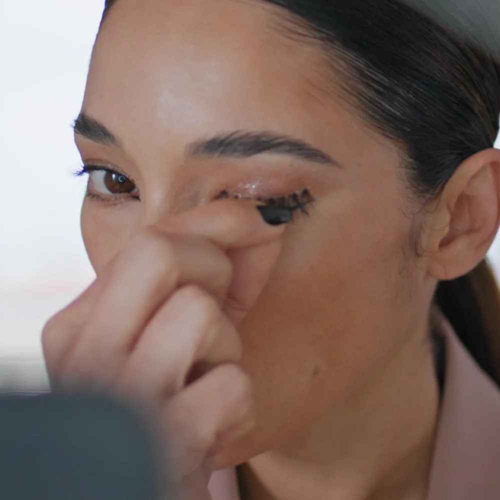 Blepharitis Symptoms