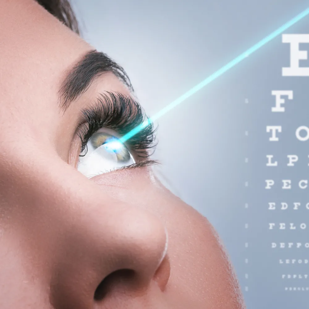Laser Refractive Surgery